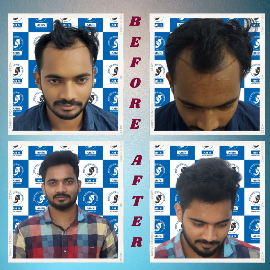 QR678 Hair Treatment Review