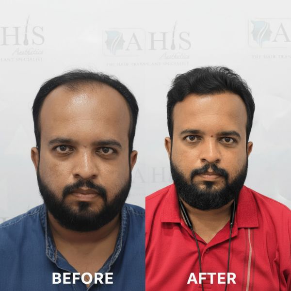 before-after-clinic (1)