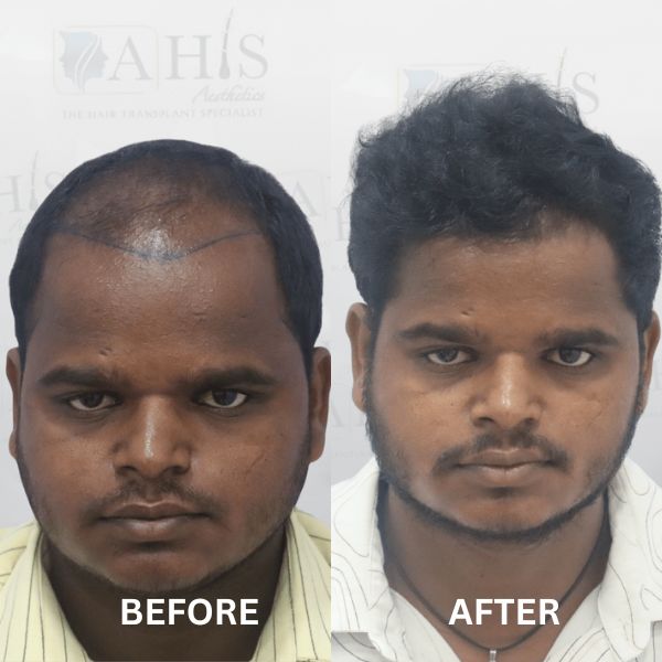 before-after-clinic (2)