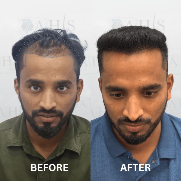 before-after-clinic (3)