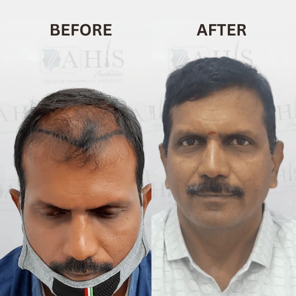 before-after-clinic (4)