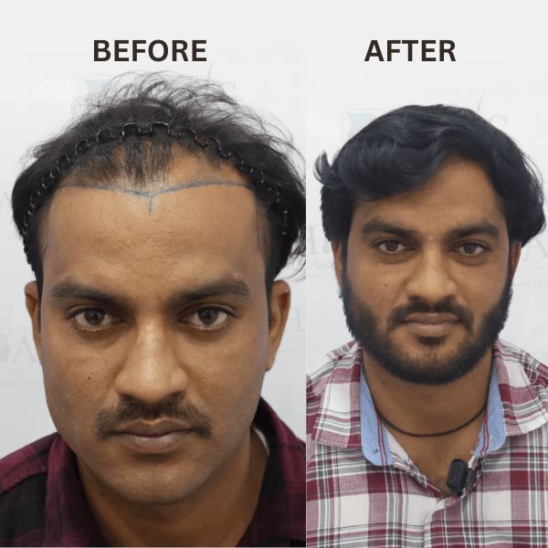 before-after-clinic (5)