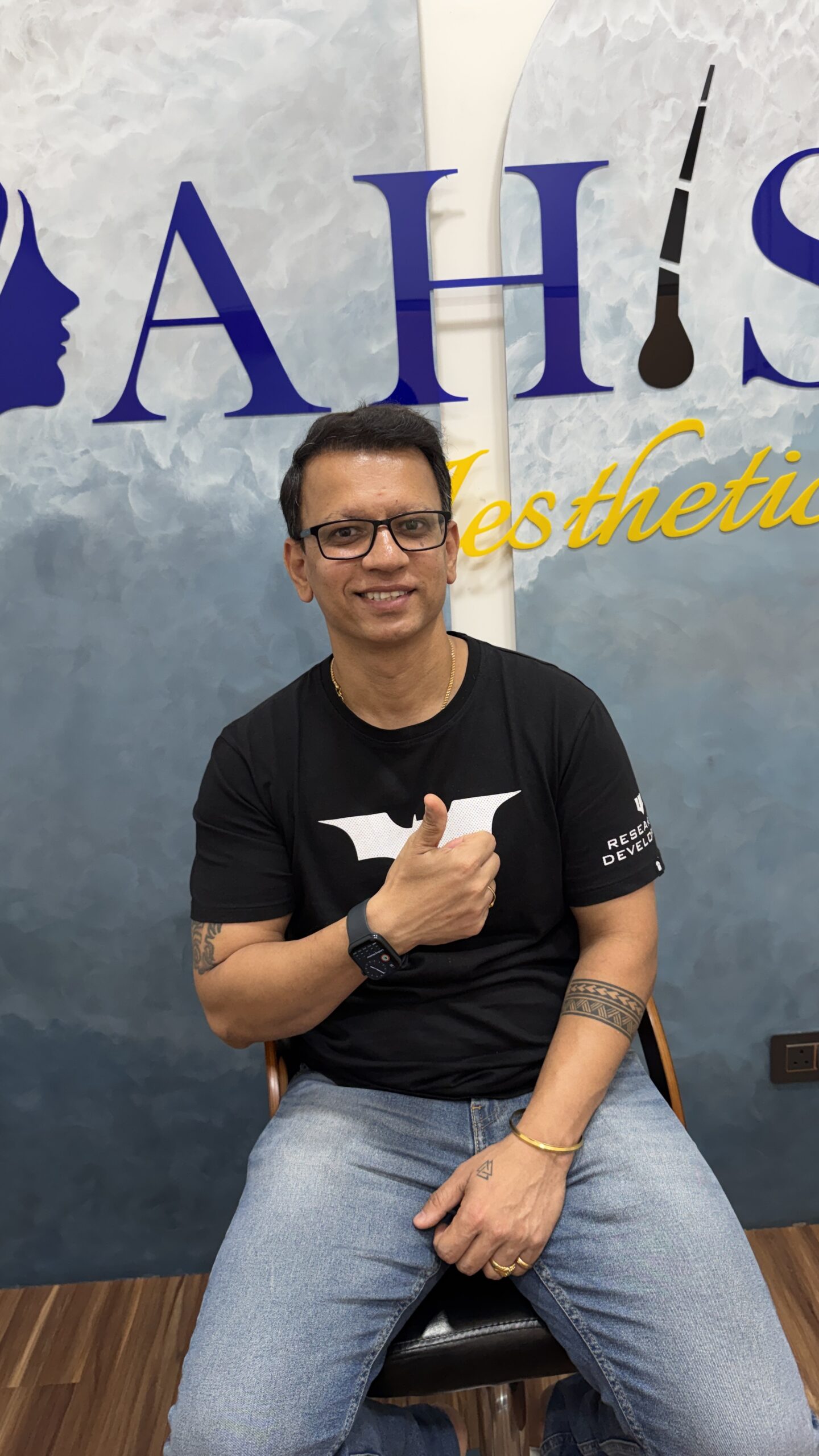 Hair transplant result after seven to eight months